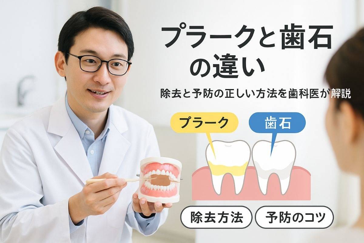 歯医者でプラークの原因と歯石の違いを解説｜除去方法と予防のコツ