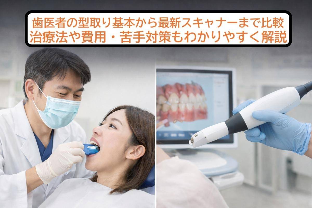 歯医者の型取り基本から最新スキャナーまで比較｜治療法や費用・苦手対策もわかりやすく解説